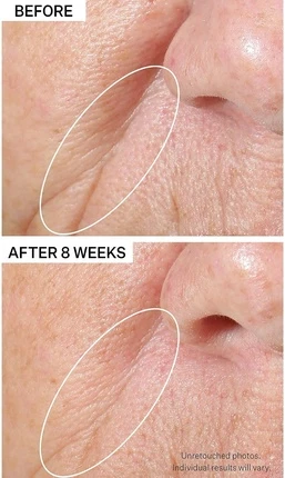 Сыворотка Strivectin Peptight для лифтинга и сияния кожи лица
