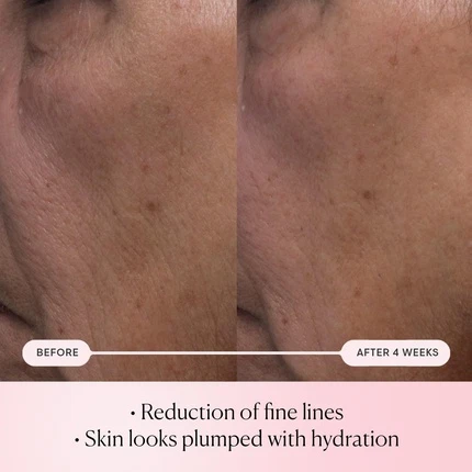Elemis Pro-Collagen Rose Micro Serum namlik beruvchi uchun