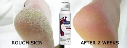 Footlogix oyoq kremi