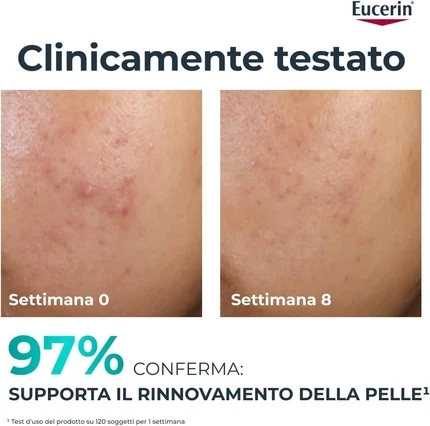 Yuz uchun Eucerin Dermopure Clinical eksfoliyatsiyalovchi vositasi