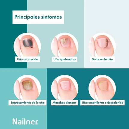 Антигрибковая ручка для ногтей Nailner