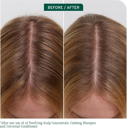 Концентрат для кожи головы Biolage Scalp Sync Purifying Concentrate Балансирует влажность кожи головы