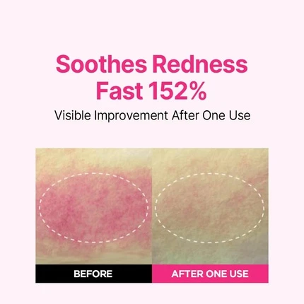 Увлажняющая сыворотка Isoi Blemish Care Up Serum