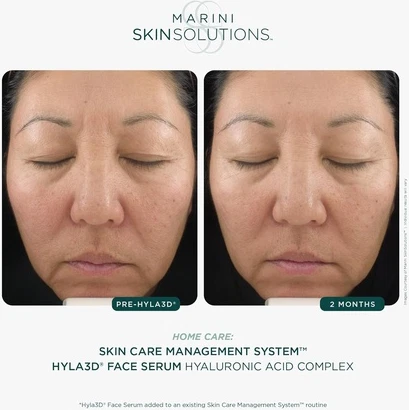 Marini Skinsolutions Hyla3D Сыворотка для лица